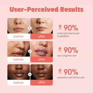 <span class=keywords><strong>Crema</strong></span> Gel Idratante Viso Joyvin al <span class=keywords><strong>Collagene</strong></span> e Niacinamide, Ordini Minimi Accettati, per una Pelle Luminosa, Senza Parabeni - Product Image 2