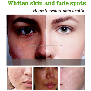 2024 OEM Luxus Glutathion Aufhellung mit Vitamin C Kollagen Kapseln Haut aufhellung L-Glutathion 7 In 1 Feuchtigkeit kapsel - Product Image 4