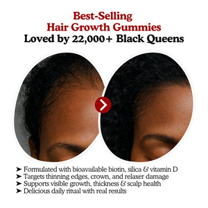 Gomitas para el Crecimiento del Cabello OEM, Suplemento de Belleza para un Cabello Saludable, con <span class=keywords><strong>Vitamina</strong></span> D Añadida - Product Image 3