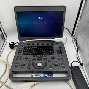 Échographe Doppler Couleur Portable Sonoscape X3 15,6'' Autonomie 90 min 3 sondes Abdomen Obstétrique Gynécologie Cardiologie CE - Product Image 5