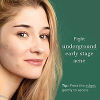 Nouveau patch anti-acné microneedle de technologie avec patch anti-acné dissolvable pour un zit profond au stade précoce