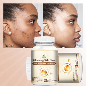 Huid Whitening Pillen Kruidensupplement Glutathion Vitamine C Collageen Liposomale <span class=keywords><strong>Capsules</strong></span> Voor Huidverzorging Verheldering - Product Image 3