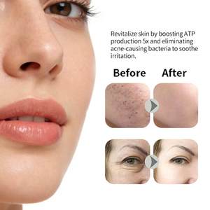 Appareil de Soin Anti-Âge et Raffermissant pour le Visage : Sculpteur de Ligne Maxillaire, Croissance Capillaire, Lifting Cutané, Thérapie Électrothérapie Haute Fréquence - Product Image 4