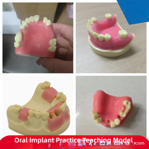 Modelo de práctica de implante dental anatómico con Molde de resina, entrenamiento de ciencia médica, hueso simulado y encías blandas, diente faltante - Product Image 5