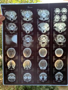 Bán buôn A3 tùy chỉnh kích thước tấm cuộn màu xanh phun y tế phim cho y tế in ấn hình ảnh x Ray ct, CR, Dr, MTR, PET-CT vv. - Product Image 6