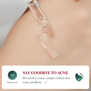OEM extrait d'acide <span class=keywords><strong>salicylique</strong></span> de rose traitement original de l'acné dissolvant de points noirs sérum de soin de la peau ordinaire - Product Image 5