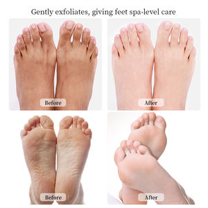 Jelly Foot Soak, Exfoliante de azúcar, Máscara de barro, Crema para pies Kit de pedicura de 4 Pasos para pies en casa Kit de spa para pies - Product Image 4