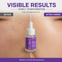 Serum Vitamin C Potensi Tinggi 20% Niacinamide dengan Ekstrak Meadowsweet, Pencerah Wajah Cair 20ml, Label Pribadi Kustom OEM
