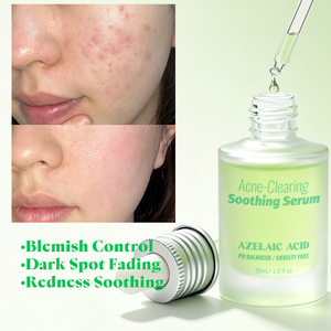Suero Antiacné con Ácido Azelaico, Centella Asiática y Pantenol: Control de Imperfecciones, Calmante para el Enrojecimiento, Atenúa Manchas Oscuras - Product Image 1