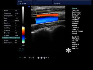 Máquina de ultrasonido <span class=keywords><strong>Doppler</strong></span> 4D para ordenador portátil, máquina de ultrasonido DW-L5 a Color, el mejor precio - Product Image 5
