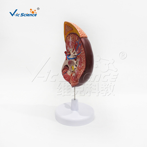 Modèle anatomique de rein agrandi 3 fois avec glande surrénalette pour l'éducation des patients en néphrologie - Product Image 3