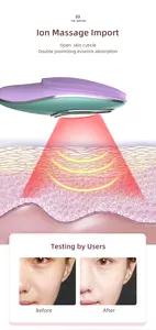 <span class=keywords><strong>4</strong></span> en <span class=keywords><strong>1</strong></span> EMS Micro corriente de silicona cepillo de limpieza facial masajeador recargable a prueba de agua - Product Image 4