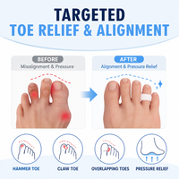 Anneaux séparateurs d'orteils en gel de silicone pour la correction du hallux valgus, orthopédiques, pour le yoga, écarteurs et redresseurs d'orteils
