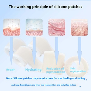 Nastro per la cura della cicatrice di bellezza e per la cura della cicatrice in Silicone di grado impermeabile di vendita calda - Product Image 3