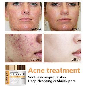 Coussinets exfoliants en acide de glycines pour le visage, 10 pièces, tampons pour le visage, Essence Anti-acné, effet éclaircissant, pour <span class=keywords><strong>taches</strong></span> foncées - Product Image 3