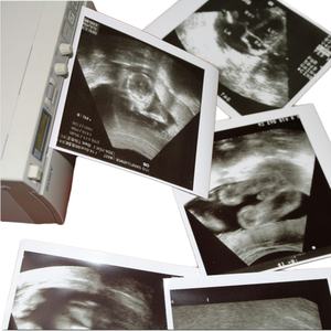 FOISON Single Layer Ultrasound Thermal <b>Paper</b> <b>Roll</b> for UPP 110S Medical Examination High Definition 10 <b>Rolls</b>/Box - Product Image 6