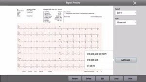 Fabricant professionnel d'équipements ECG vétérinaires Mindray BeneHeart R700 R900 pour le diagnostic animal - Product Image 6