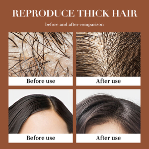 Shampoo anti-chute de cheveux au gingembre SADOER 500mL, antipelliculaire, contrôle du sébum, hydrate, nourrit, nettoyage en profondeur des cheveux - Product Image 5