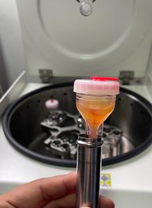 Kit de plasma riche en plaquettes autologues pour le rajeunissement de la peau et la croissance des cheveux - Product Image 2