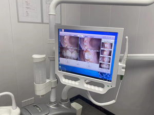 Écran tactile 17 pouces Endoscope dentaire 12 millions de pixels - Product Image 4