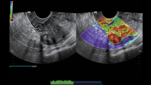 Appareil d'échographie Mindray Nuewa I9 pour usage vétérinaire avec système d'imagerie diagnostique et échographie Doppler couleur Full HD - Product Image 6