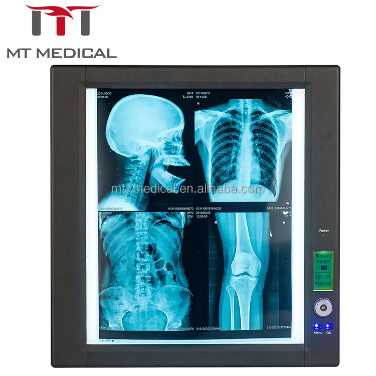 Mt Medische Led Medische X-Ray Single-Side X-Ray Film Viewer X Ray Film Viewer