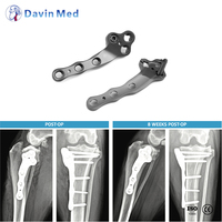 Système de plaques de blocage en titane TPLO pour la chirurgie orthopédique vétérinaire des ligaments croisés chez les petits animaux