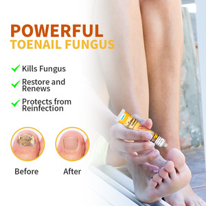 ครีมทาเล็บจากเชื้อราที่เล็บฟื้นฟูเล็บและเล็บเท้า - Product Image 3