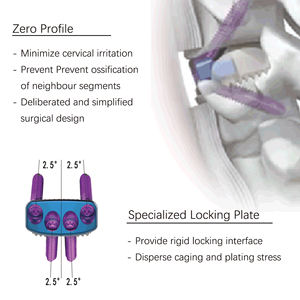 CANWELL PEEK Zero Profile <span class=keywords><strong>Cervical</strong></span> <span class=keywords><strong>Fusion</strong></span> Cage Anterior <span class=keywords><strong>Cervical</strong></span> Interbody Implant untuk Sistem Bedah Tulang Belakang ACDF - Product Image 5