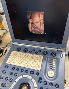 Fourniture et réparation de la machine à ultrasons portable Voluson e VolusonE Voluson.e - Product Image 2