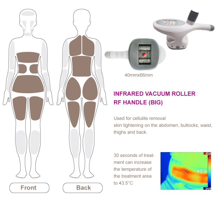 800w 2mhz Rf Body Sculpting Machine Cellulite Reduction Vacuum Shape Machine