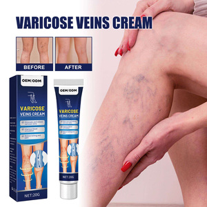 Crème Végétale pour <span class=keywords><strong>Varices</strong></span> Écologique Personnalisable pour le Soulagement des Douleurs Corporelles et le <span class=keywords><strong>Traitement</strong></span> des Vascularites - Product Image 4