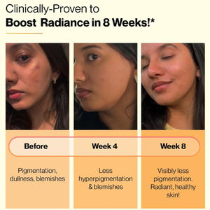 แท็บเล็ตช่วยให้ผิวขาวใสมีวิตามินซีสำหรับสารต้านอนุมูลอิสระและกลูตาไธโอนผิวขาว - Product Image 5