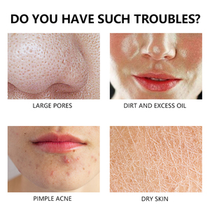 Ampolla Exfoliante de Arroz OEM, Eliminador de Manchas Oscuras, Colágeno y Vitamina C, Suero Facial Hidratante - Product Image 4
