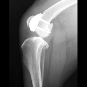 Runphy Professionele Veterinaire Knieprothese Patellagroef Chirurgie Implantaat Prothese Titanium voor Honden/Katten/Huisdieren - Product Image 2