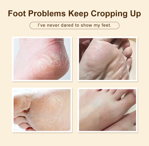 Masque nourrissant chauffant personnalisé pour les pieds, formule gingembre-igname, marque privée OEM pour les propriétaires de marques de beauté - Product Image 3