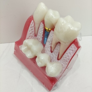 معدات تدريس تشريحية للعلوم الطبية تمرين محاكاة الأسنان عن طريق الفم نموذج زرع الأسنان البشري لدراسة الطلاب - Product Image 6