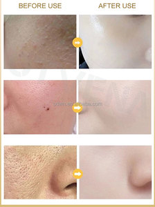 Private Label 99.99% Gold Foil Face Skin Care Bottle 20ml 24k Gold Serum for Men and Women - Product Image 6