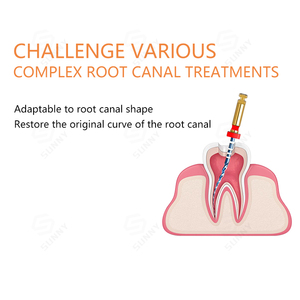 Dụng cụ nha khoa Endo Files, dụng cụ xoay nha khoa Niti, dụng cụ <span class=keywords><strong>Endodontic</strong></span> côn lớn, dụng cụ xoay Rogin - Product Image 3