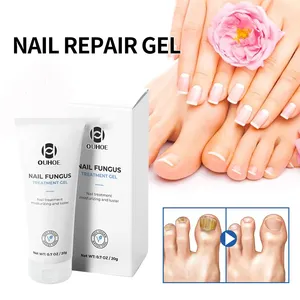 Hot Anti fungino Cream Nail Hand Foot Nail Fungus Removal Gel Anti infezione onicomicosi Nails Repair unguento 20g - Product Image 2