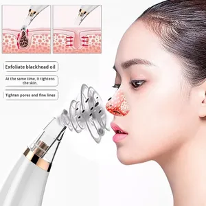 เครื่องดูดสิวเสี้ยนกันน้ำแบบไฟฟ้า พร้อมหัวดูด 3 ขนาด สำหรับทำความสะอาดรูขุมขน กำจัดสิวและเซลล์ผิวที่ตายแล้ว - Product Image 2