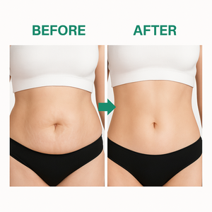 Patches de Cuidados com o Corpo das Mulheres Emagrecimento Novo Quente 8 Horas de Longa Duração Fórmula Suporte Perda de Peso Patch - Product Image 2