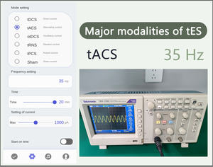 تي دي سي إس تي إيه سي إس سي إي إس تي آر إن إس |   التحفيز الكهربائي عبر الجمجمة لدعم صحة الدماغ - Product Image 5