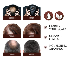 Aceite para el Crecimiento <span class=keywords><strong>del</strong></span> <span class=keywords><strong>Cabello</strong></span> 100% Natural, Orgánico y Vegano al por Mayor, Suero para el Crecimiento <span class=keywords><strong>del</strong></span> <span class=keywords><strong>Cabello</strong></span> de Marca Privada - Product Image 6