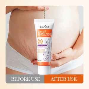Crème réparatrice anti-cicatrices et anti-vergetures <span class=keywords><strong>hydratante</strong></span> et apaisante à l'acide aminé d'avoine 40g pour femmes - Product Image 4