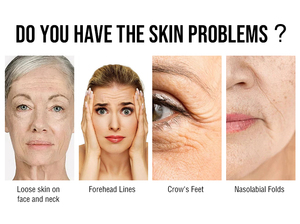 화메이 레이저 스킨 케어 휴대용 1470nm 프락셔널 레이저 피부 타이트닝 및 주름 제거 머신 (아이스 해머 포함) - Product Image 6