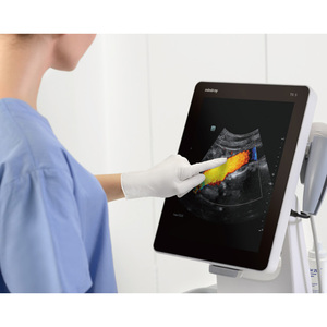 Ecógrafo Portátil a Color Mindray TE5 Vet, Imágenes de Alta Resolución, Sistema Multiprobes para Clínicas Veterinarias - Product Image 6