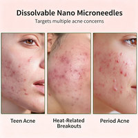 Patchs hydrocolloïdes anti-acné en forme de cœur à l'acide salicylique, traitement localisé des boutons, contrôle du sébum, soin des imperfections, emballage personnalisé
