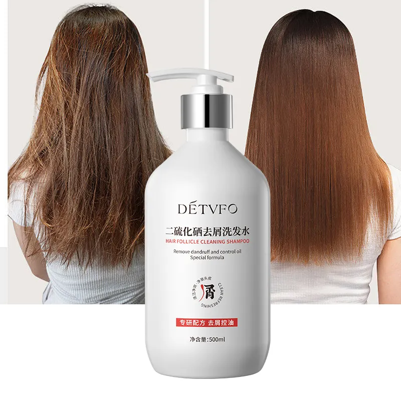 Private Label Haarproducten Plant Extract Kruidenhaar Anti-Roos Parfum Natuurlijke Vrouwen Shampoo Voor Haar Behandeling
