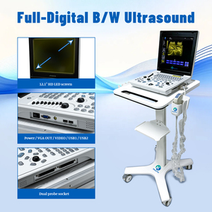 Máquina <span class=keywords><strong>de</strong></span> Ultrasonido Médica Portátil en Oferta, <span class=keywords><strong>Precio</strong></span> Bajo, Imágenes en Blanco y Negro, Sonda Dual Convexa Lineal, Veterinaria y Humana - Product Image 5